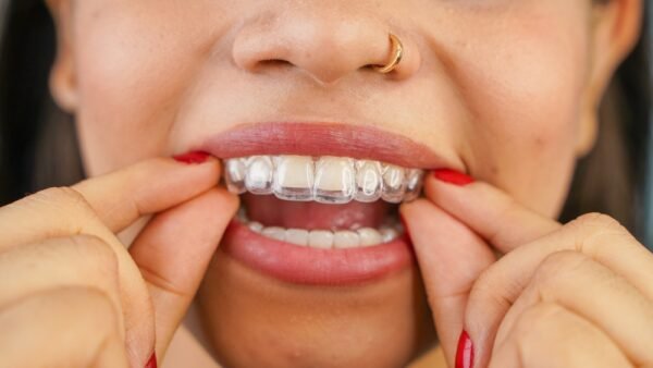 invisalign beverly hills