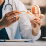 Partial Dentures