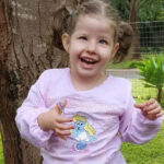 PWS Syndrome Symptoms