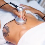 Body Sculpting Treatments