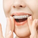 Braces Parramatta