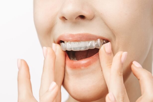 Braces Parramatta